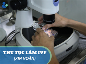 THỦ TỤC LÀM IVF CỦA CẶP VỢ CHỒNG XIN NOÃN